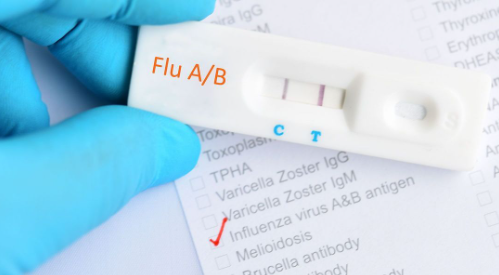 Contexte et traitement du test de diagnostic rapide de la grippe