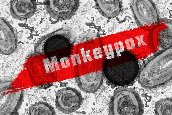 Antigène d'essai d'écouvillon Harga: plus de 1000 cas de Monkeypox ont été diagnostiqués dans de nombreux pays!
